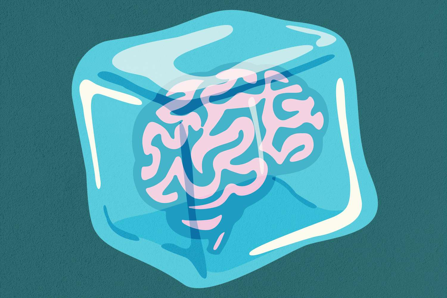 Team Brainfreeze